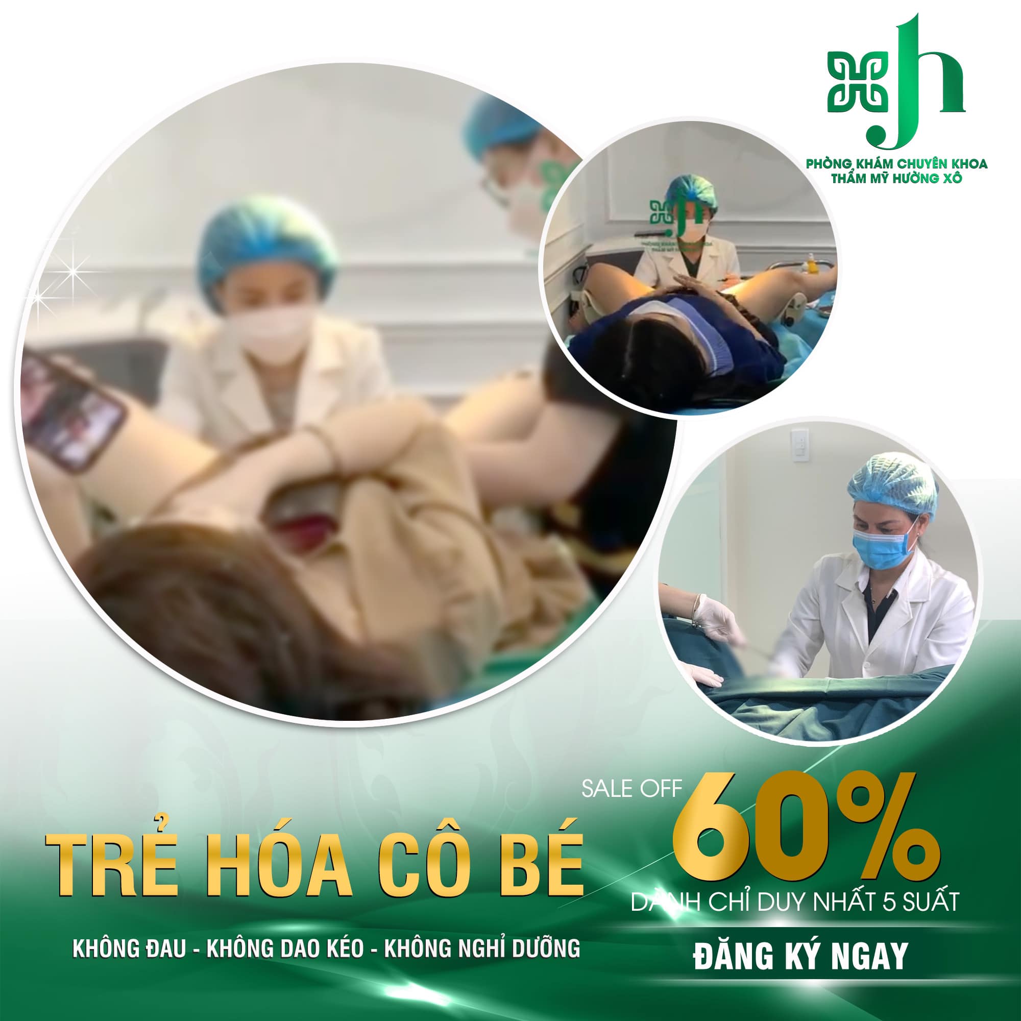 Thu gọn môi lớn môi bé