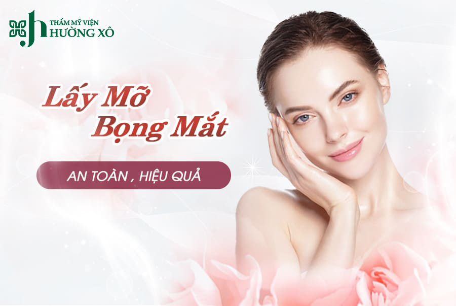 Lấy mỡ bọng mắt