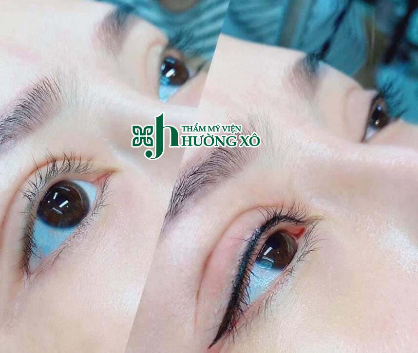 Phun mí mở tròng