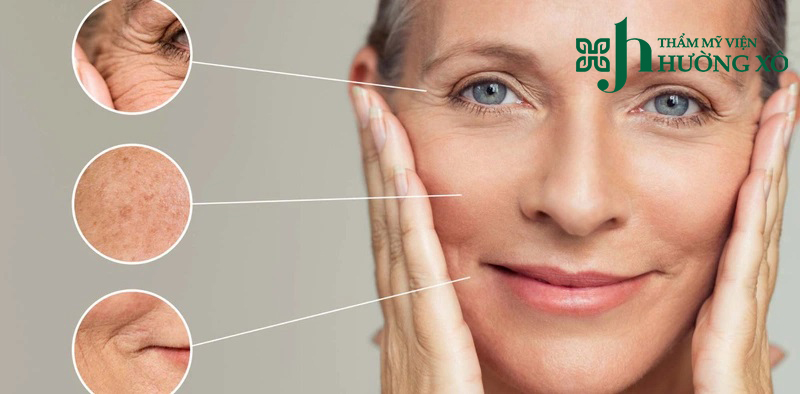 Độn rãnh cười