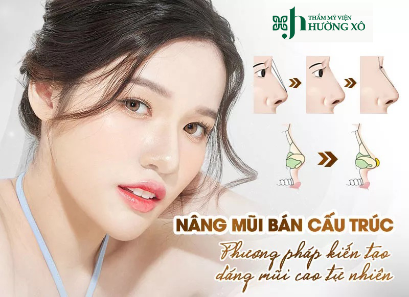 Nâng mũi cấu trúc