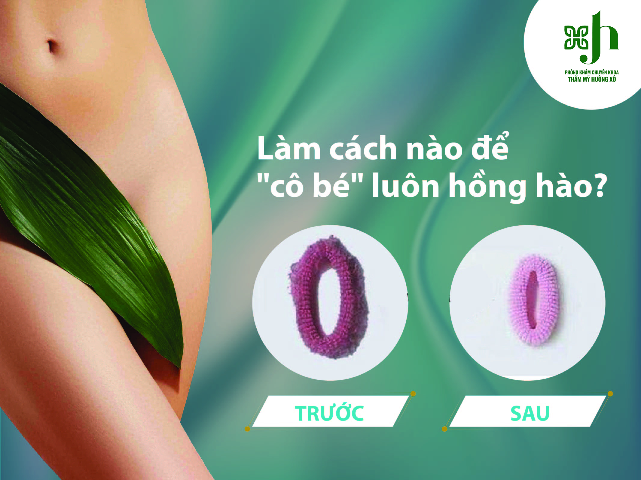 Làm hồng âm đạo