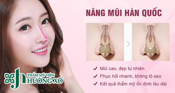 Nâng mũi Hàn Quốc