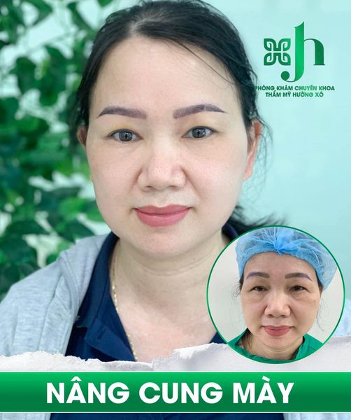 Nâng cung chân mày