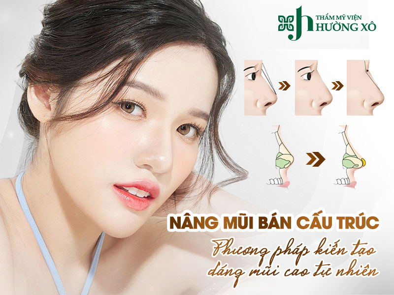 Nâng mũi bán cấu trúc