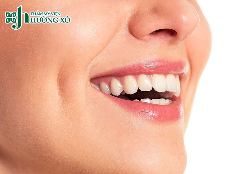 Tạo má lúm đồng tiền