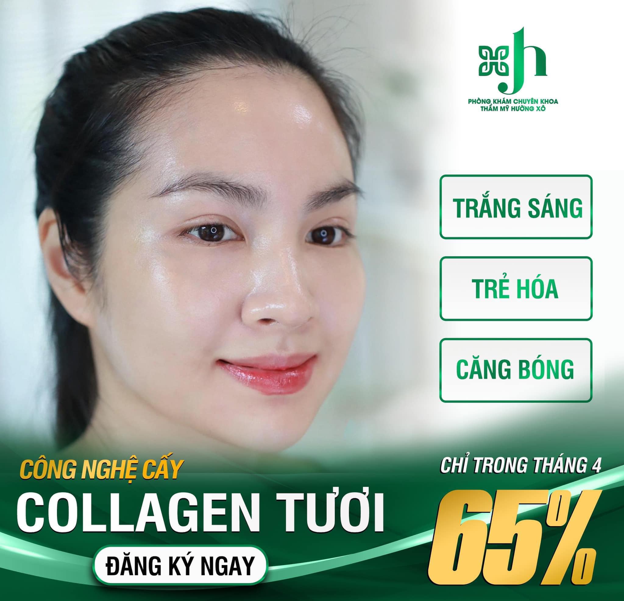 Cấy collagen tươi
