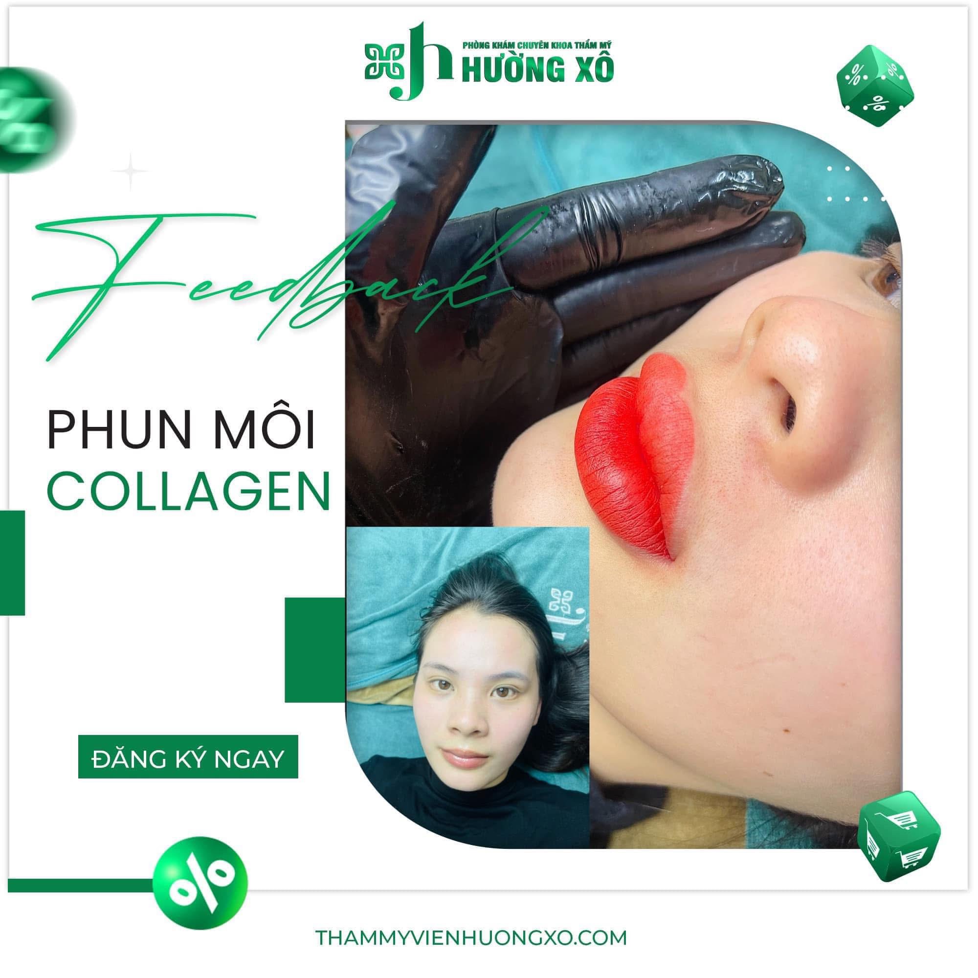 Phun môi collagen