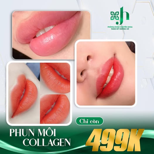 Phun môi collagen