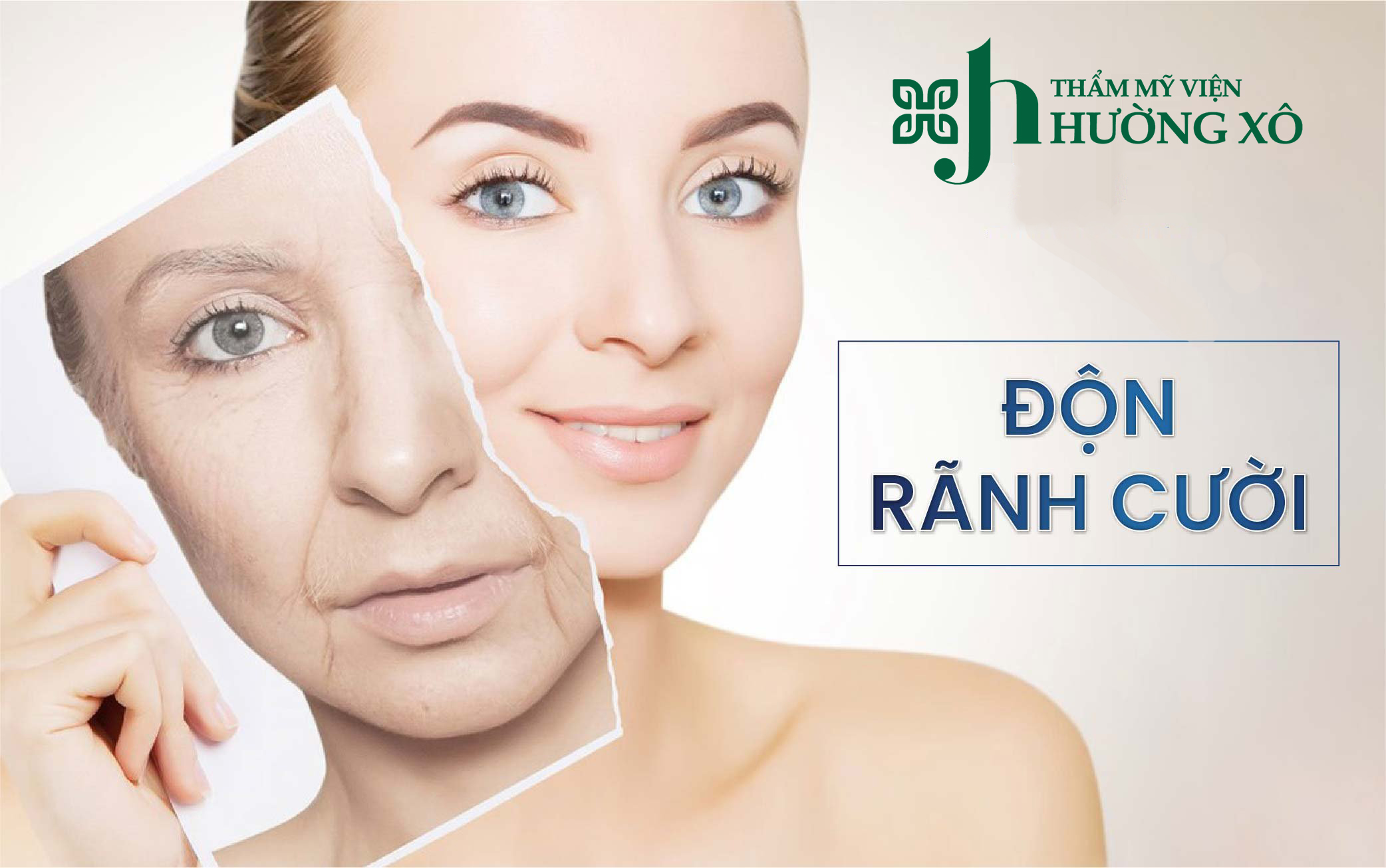 Độn rãnh cười