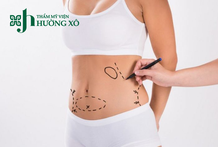 Dịch Vụ Hút Mỡ Vaser Lipo Uy Tín Tại Vinh