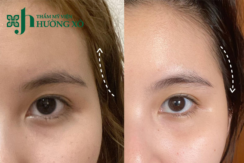 Độn thái dương