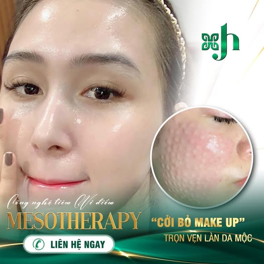Tiêm meso căng bóng da