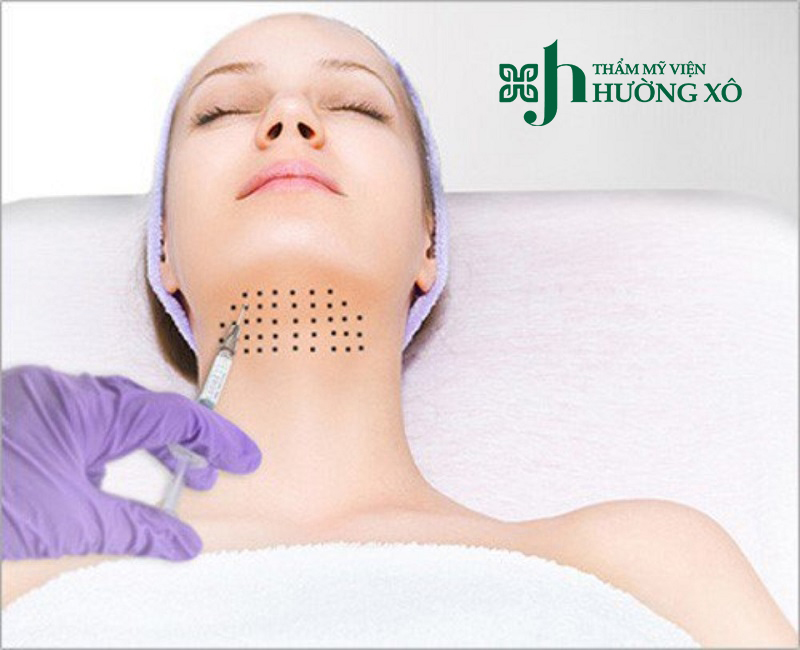 Tiêm tan nọng cằm