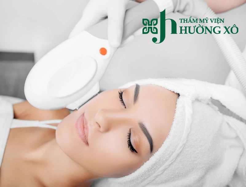 Triệt lông mép bằng laser diode