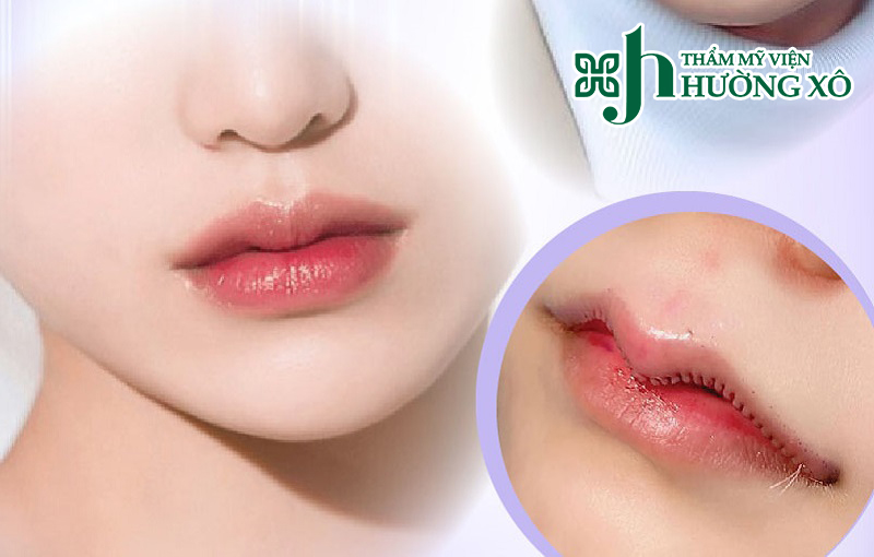 Tạo môi trái tim