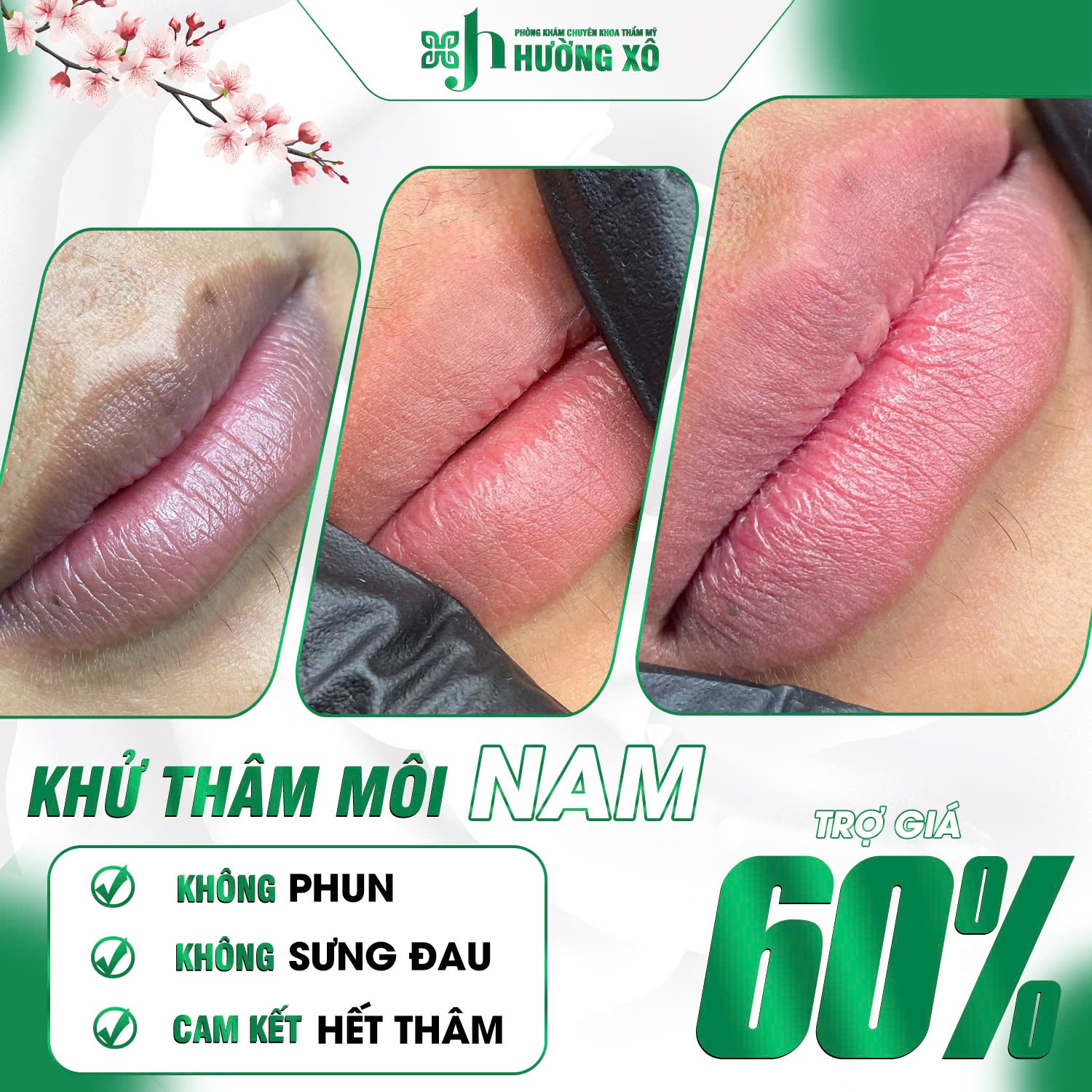 Khử thâm môi