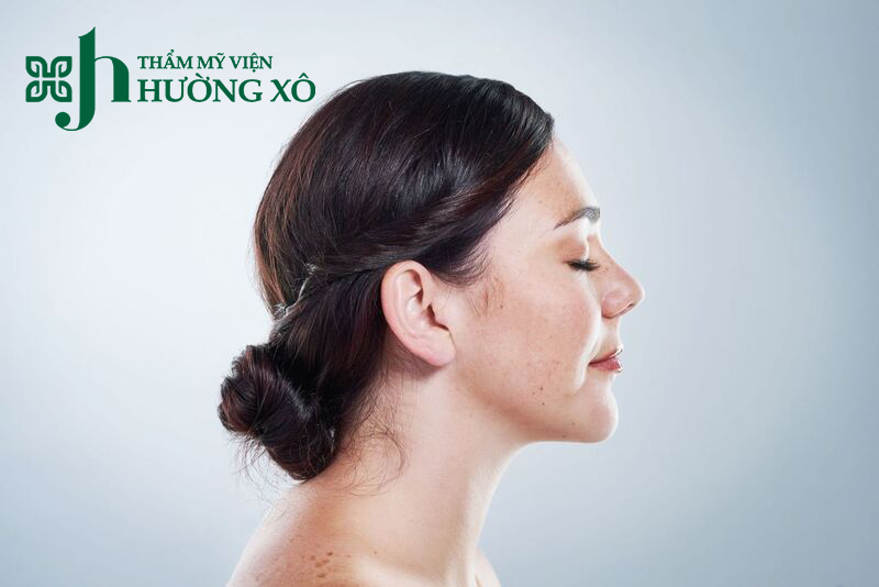 Điều trị tàn nhang