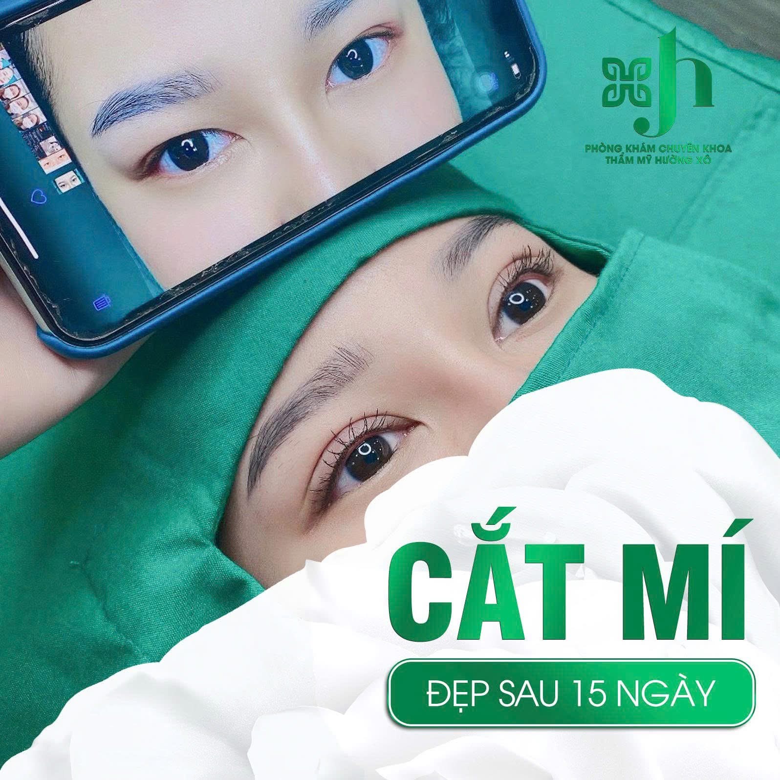 Cắt mí nội soi