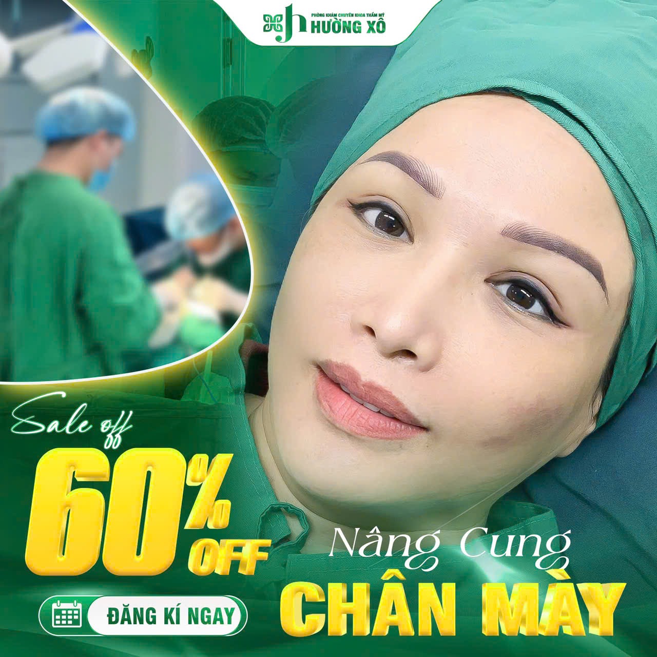 Nâng cung chân mày