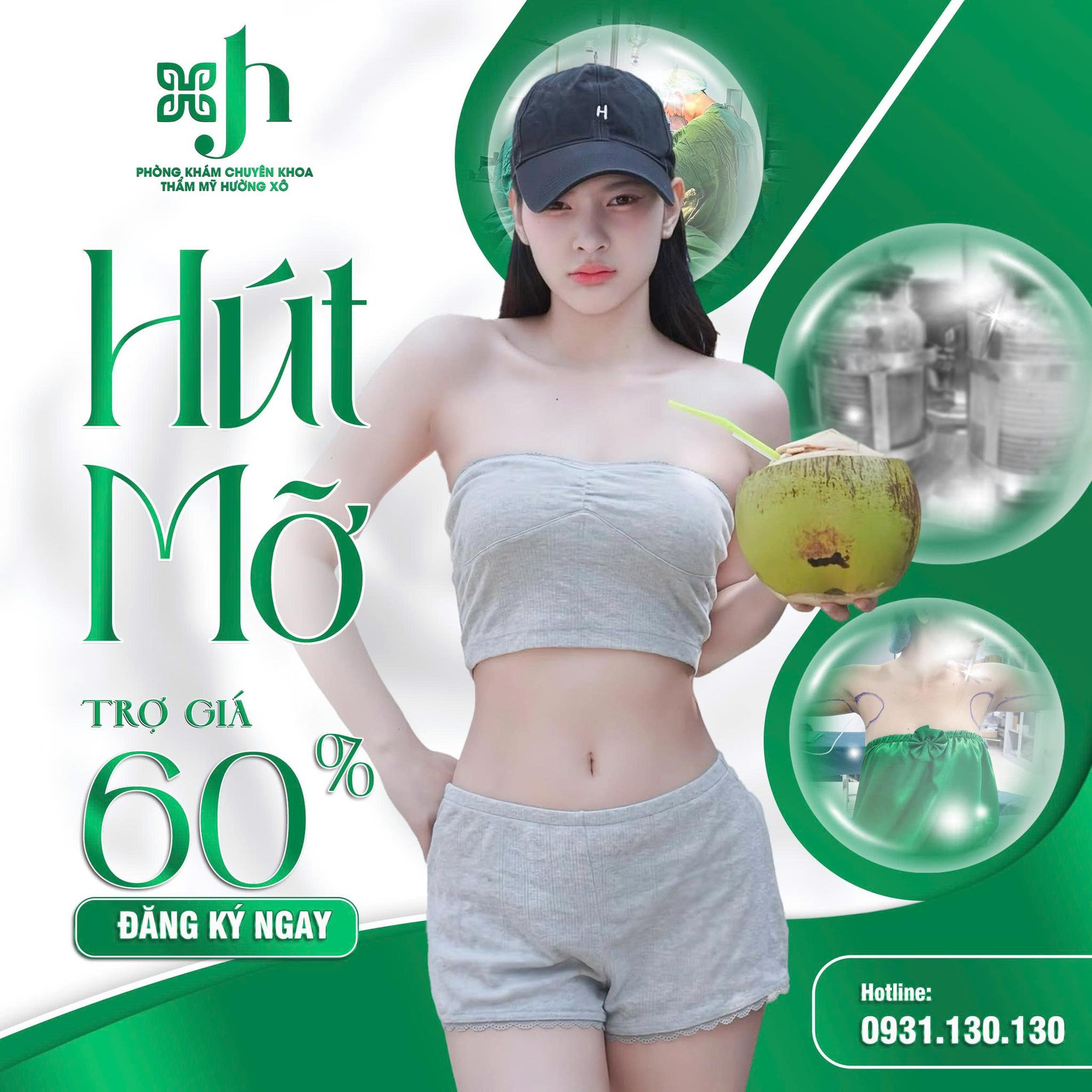 Hút mỡ bụng