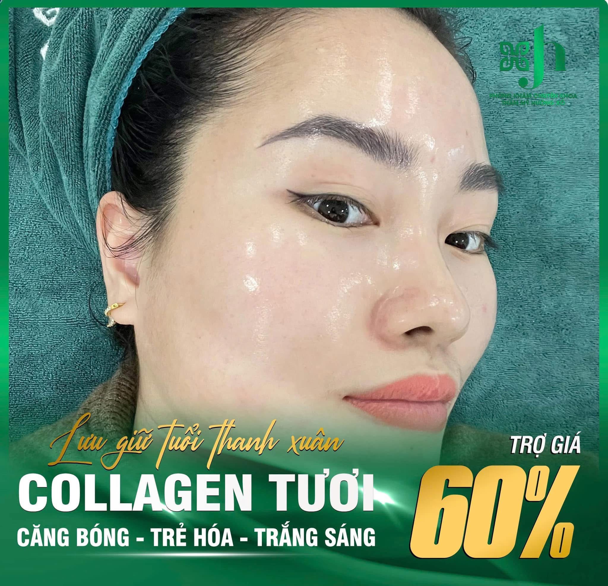 Dịch Vụ Cấy Collagen Tươi Uy Tín Tại Hà Tĩnh