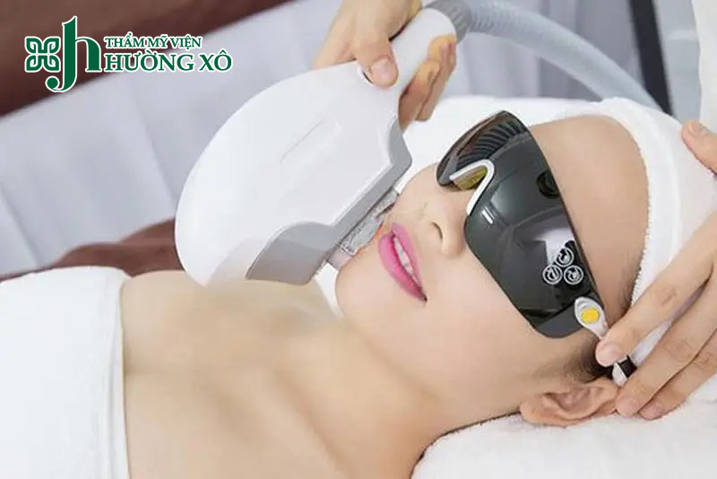 Dịch vụ triệt lông