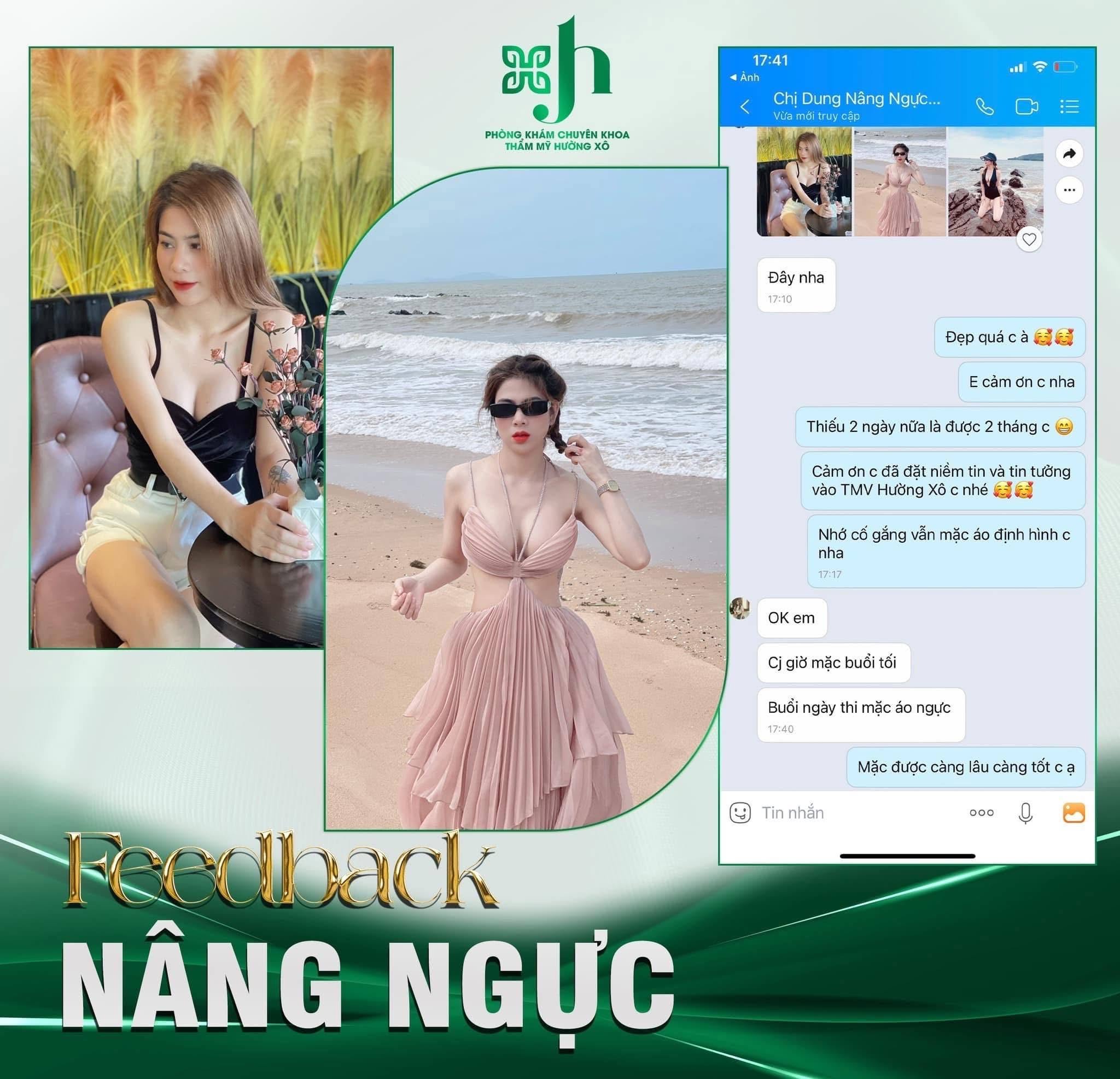 Nâng ngực