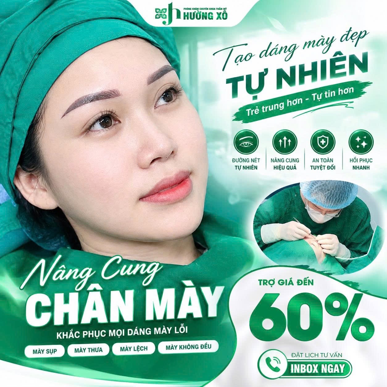 Nâng cung chân mày