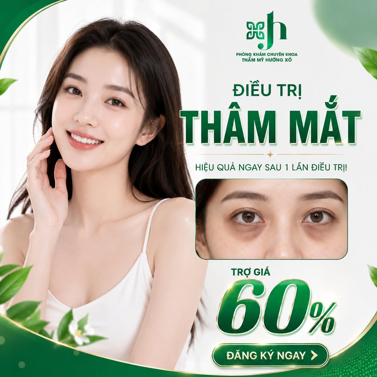 Điều trị thâm mắt