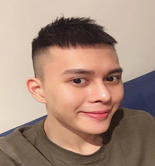 Phẩu thuật độn cằm tại Vinh, Nghệ An