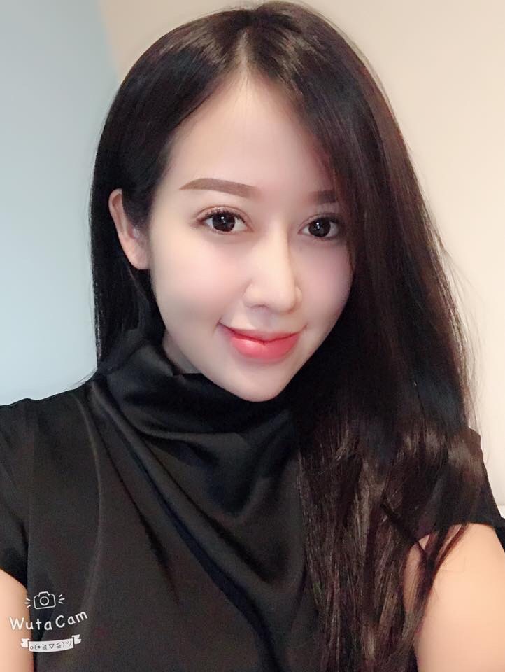 Phẫu thuật độn cằm tại Vinh