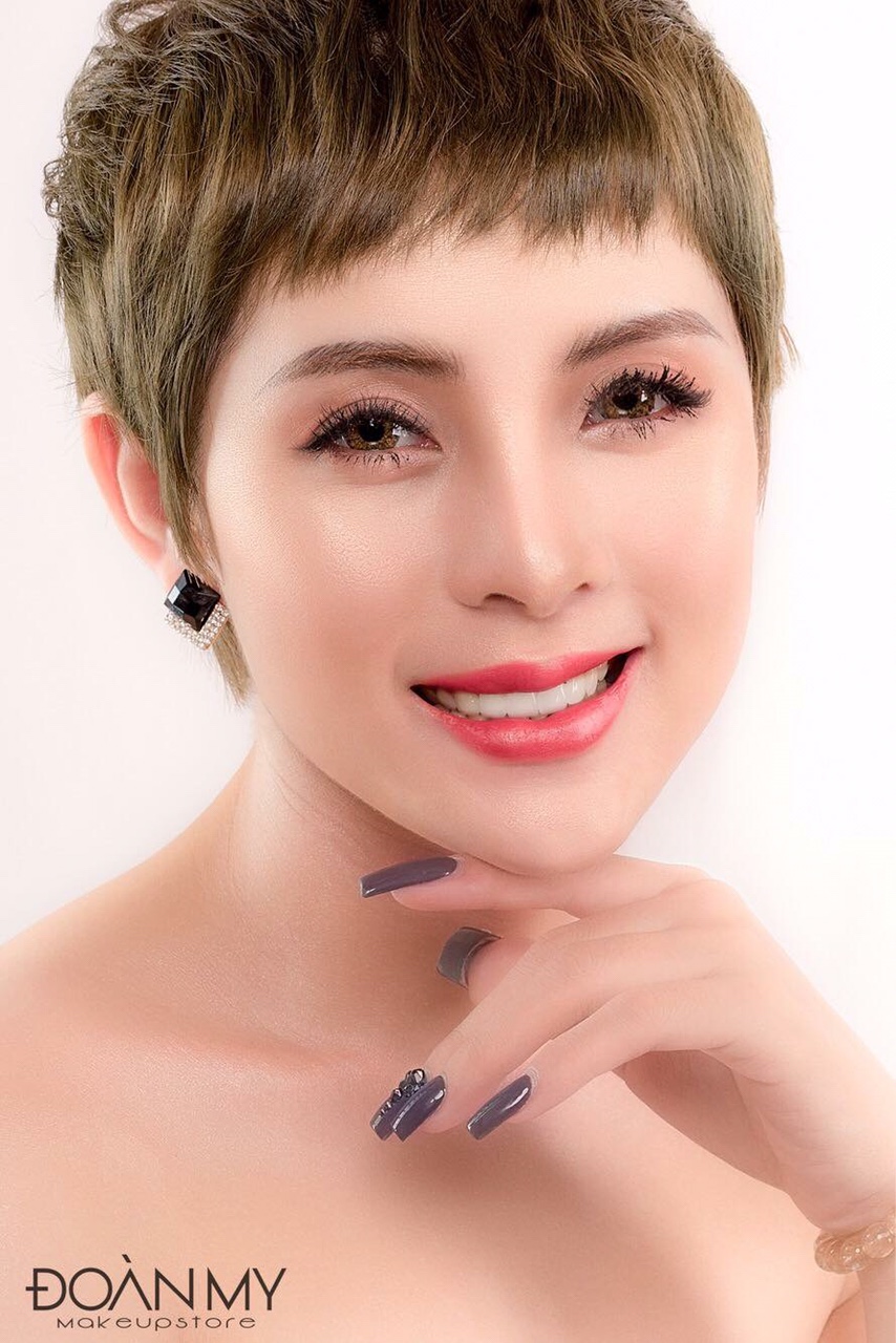 Phẫu thuật độn cằm tại Nghệ An