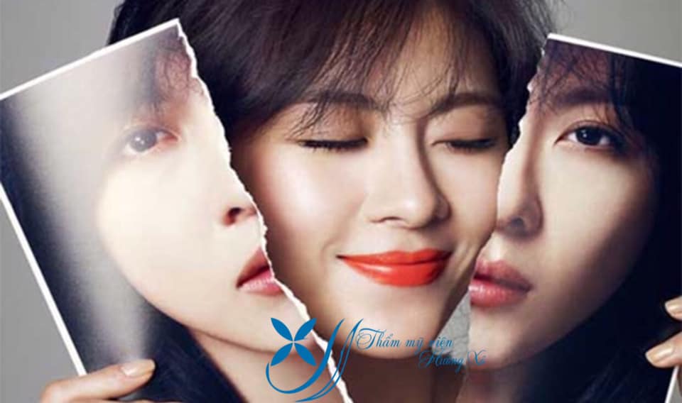 Phẫu Thuật Thẩm Mỹ