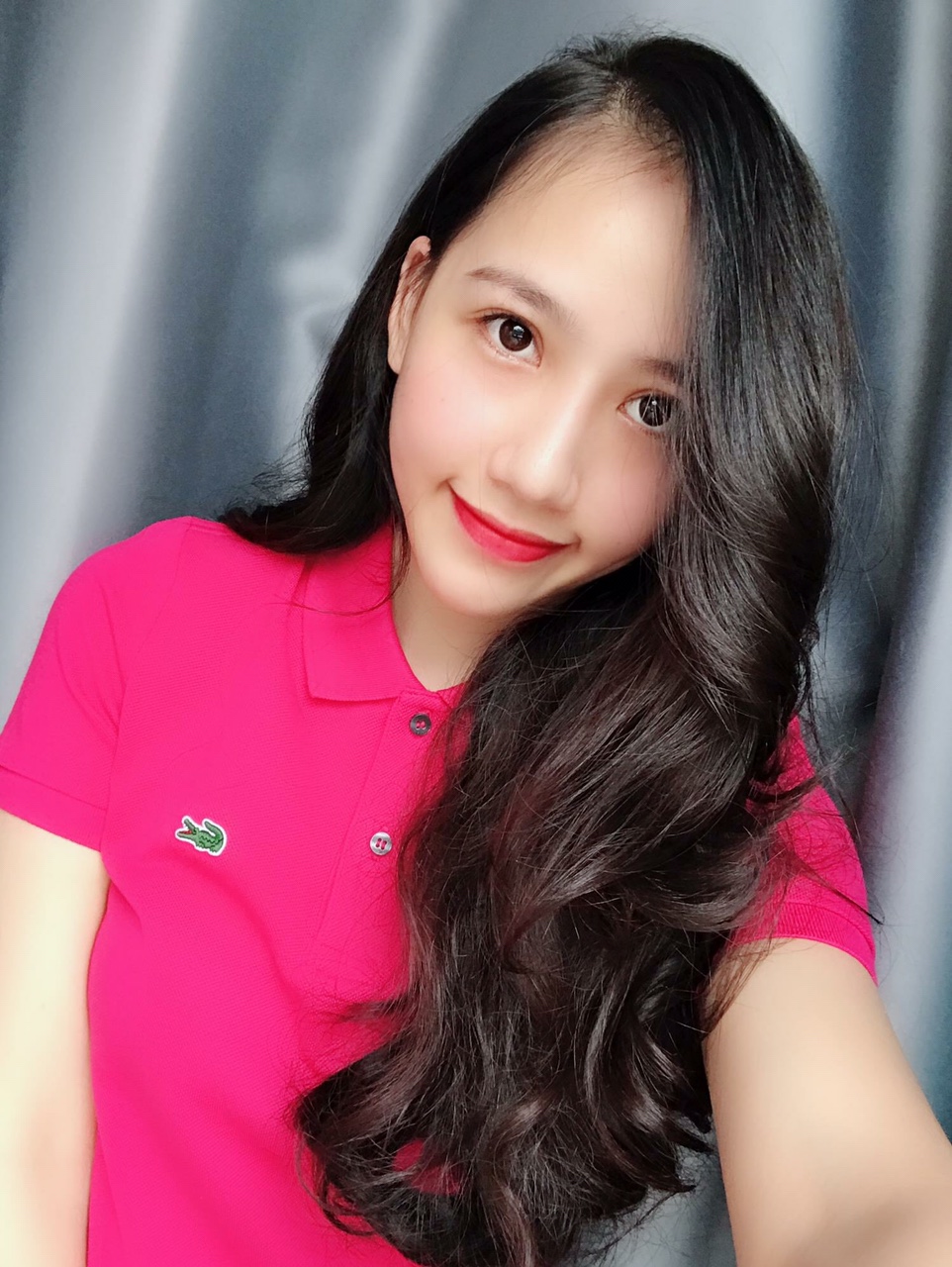 Phẫu thuật độn cằm tại Vinh, Nghệ An