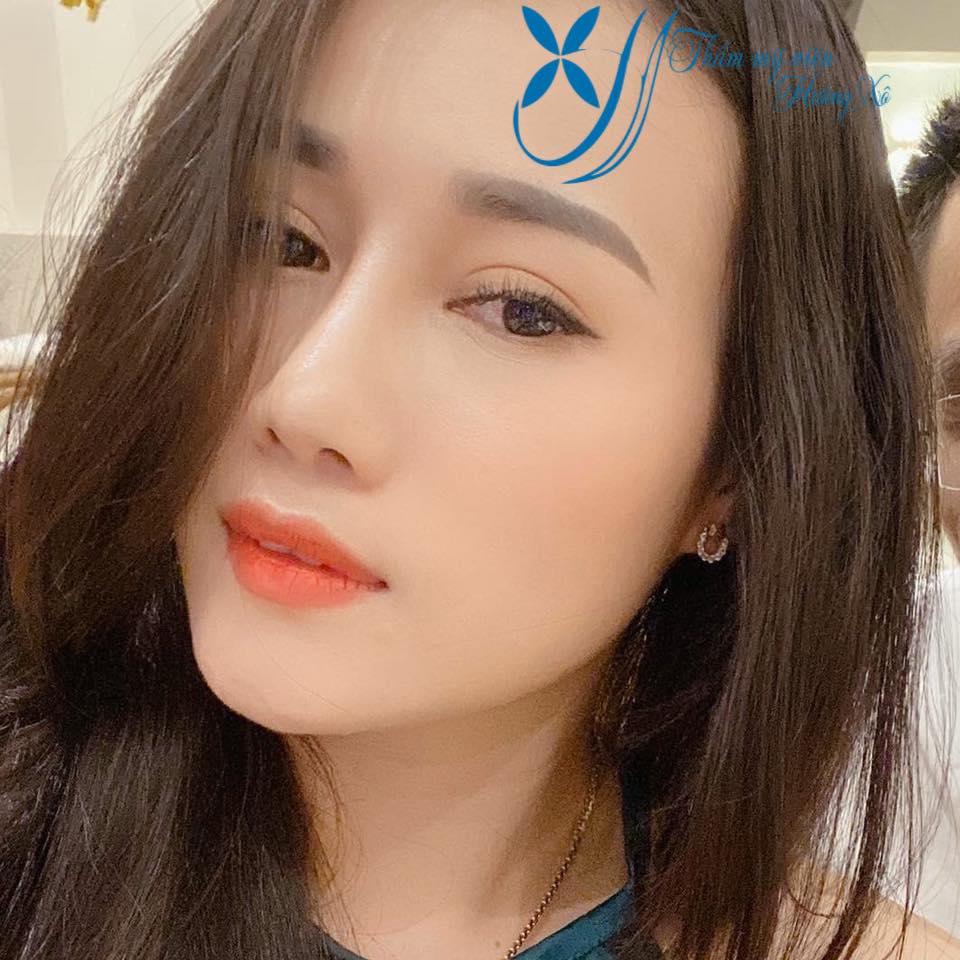 Phẫu thuật nâng mũi tại Nghệ An