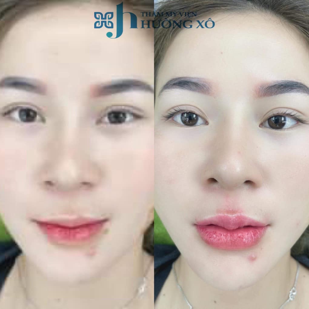 Địa Chỉ Xăm Môi Đẹp tại Hà Tĩnh