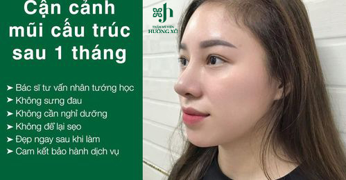 Nâng Mũi Cấu Trúc Đẹp - An Toàn - Uy Tín - Chất Lượng tại Vinh Nghệ An