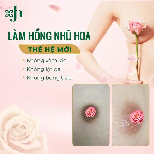 Làm Hồng Nhũ Hoa Công Nghệ Mới tại Vinh, Nghệ An