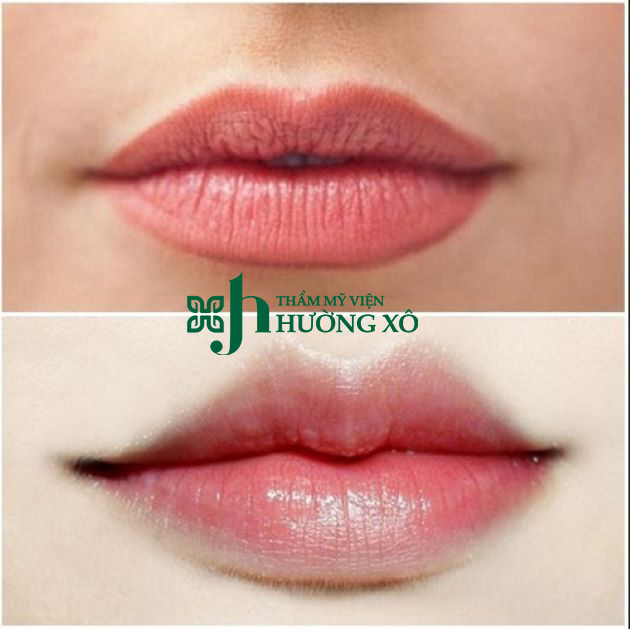 Dịch Vụ Tạo Môi Trái Tim Chất Lượng Tại Vinh, Nghệ An