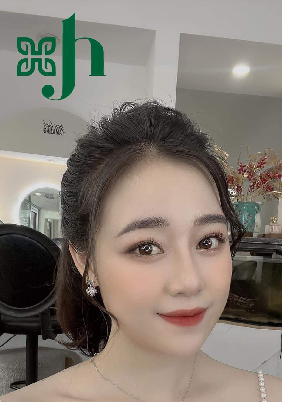 Địa Chỉ Nâng Mũi Bọc Sun Chất Lượng Tại Vinh, Nghệ An