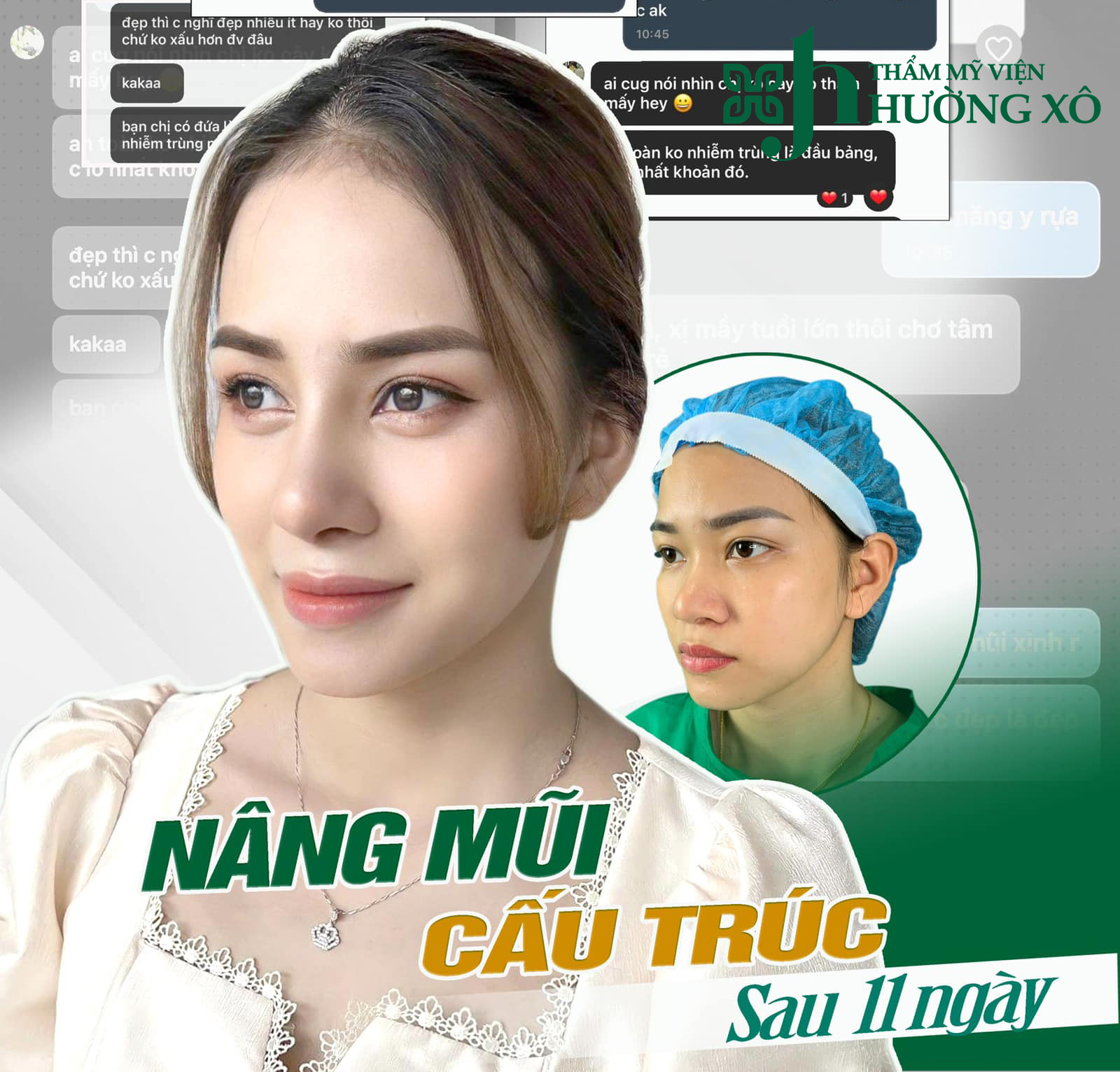 Dịch Vụ Nâng Mũi Cấu Trúc Uy Tín Tại Vinh, Nghệ An