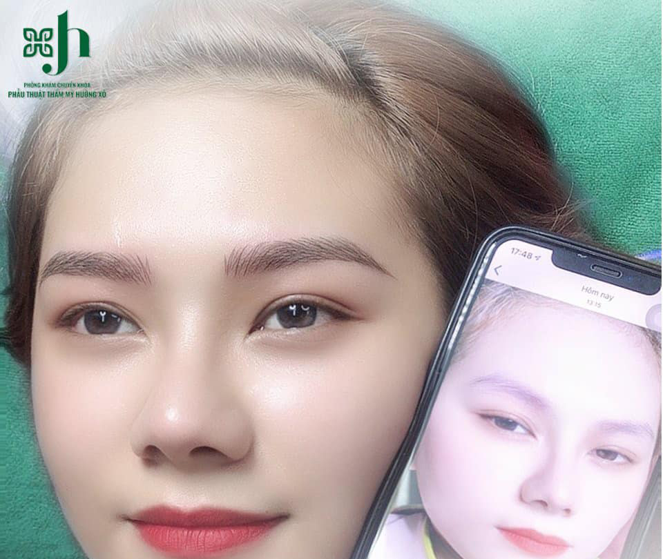 Địa Chỉ Điêu Khắc Chân Mày 3D Tại Vinh, Nghệ An