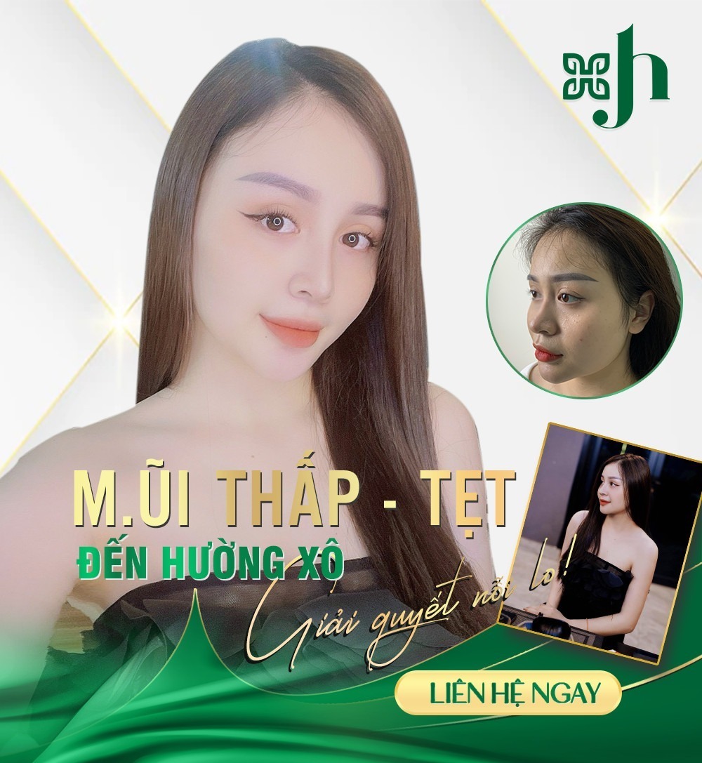 Địa Chỉ Nâng Mũi Bán Cấu Trúc Tại Vinh, Nghệ An