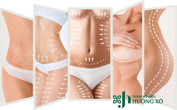 Địa Chỉ Giảm Béo Smart Lipo Uy Tín Tại Hà Tĩnh