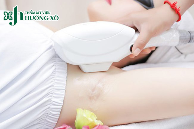 Địa Chỉ Triệt Lông Nách Uy Tín Tại Hà Tĩnh