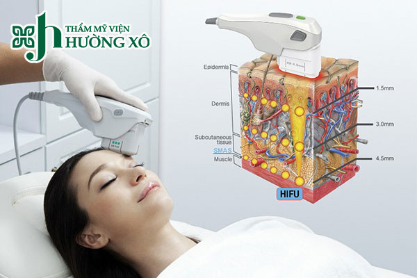 Dịch Vụ Nâng Cơ Hifu Uy Tín Tại Vinh