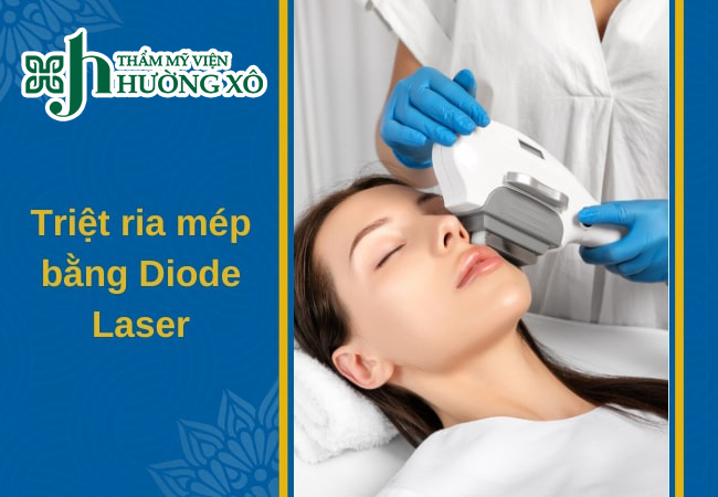 Triệt Lông Mép Bằng Công Nghệ Laser Diode Tại Vinh