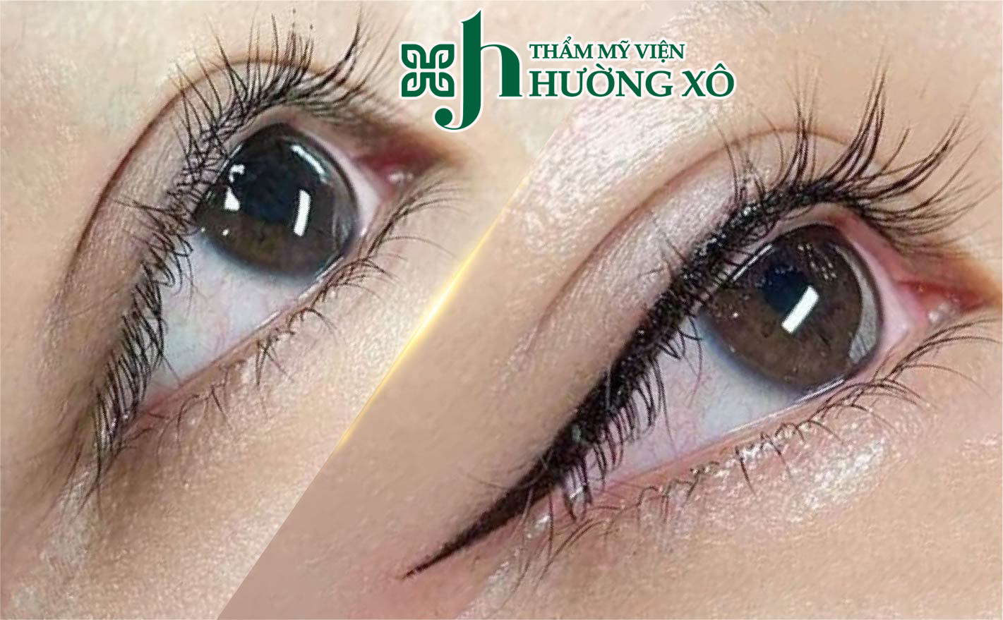 Khám Phá Dịch Vụ Phun Mí Eyeliner Uy Tín Tại Vinh