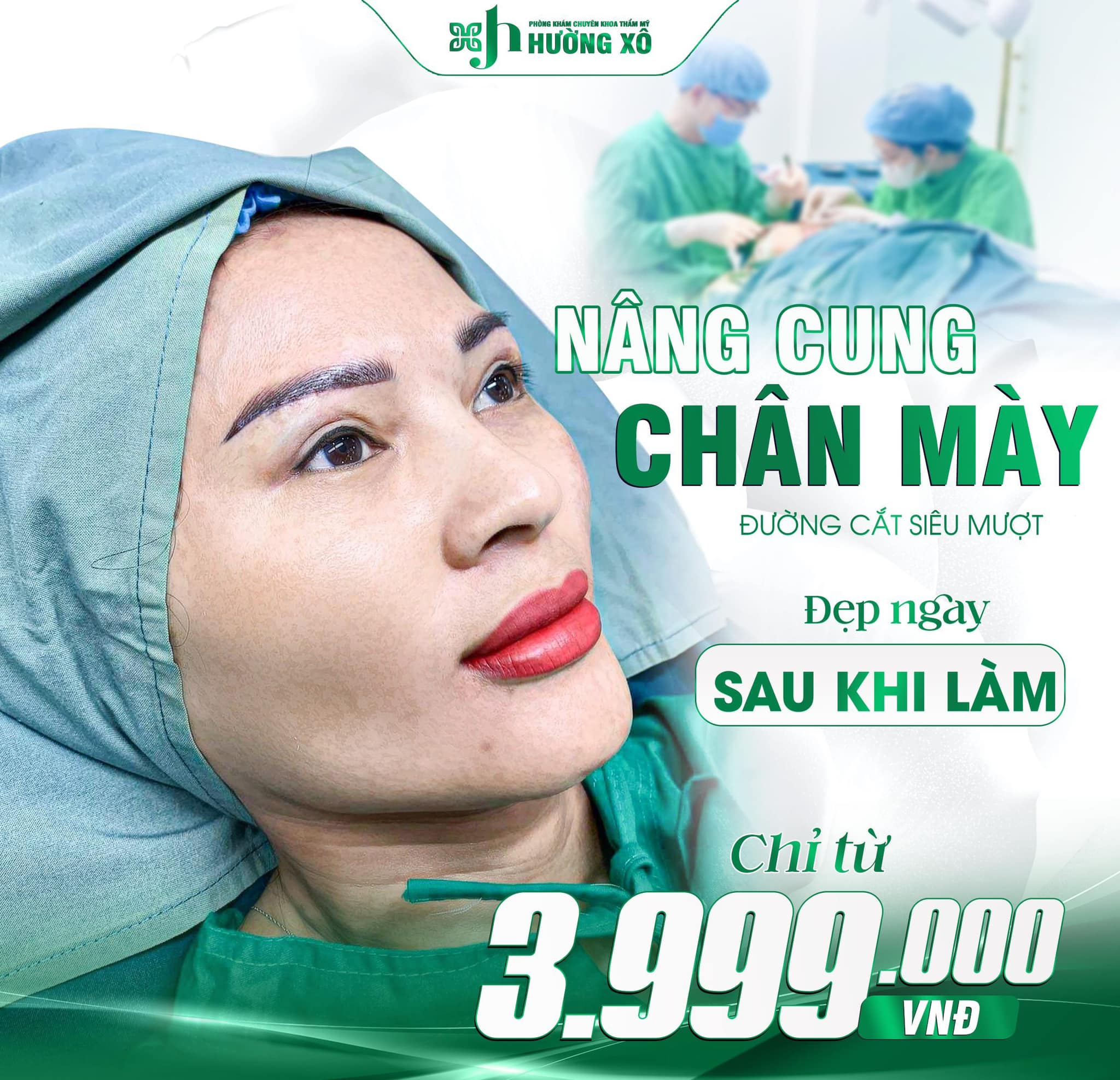 Trải Nghiệm Nâng Cung Chân Mày Uy Tín Tại Hà Tĩnh